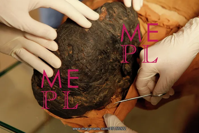  : Tissue sampling operation of an Egyptian mummy