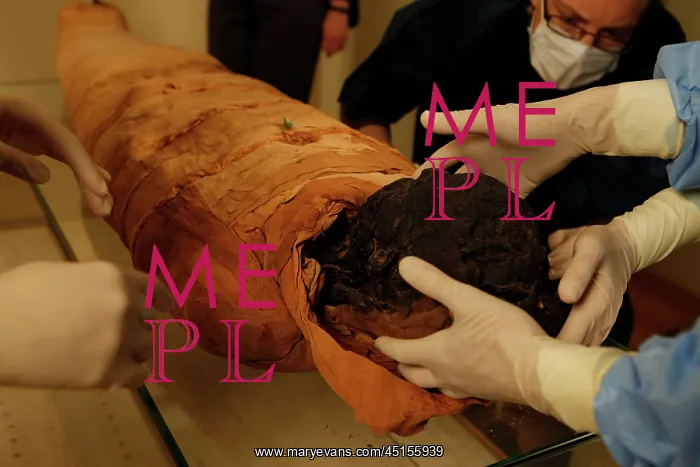 : Tissue sampling operation of an Egyptian mummy : Tissue sampling operation of an Egyptian mummy