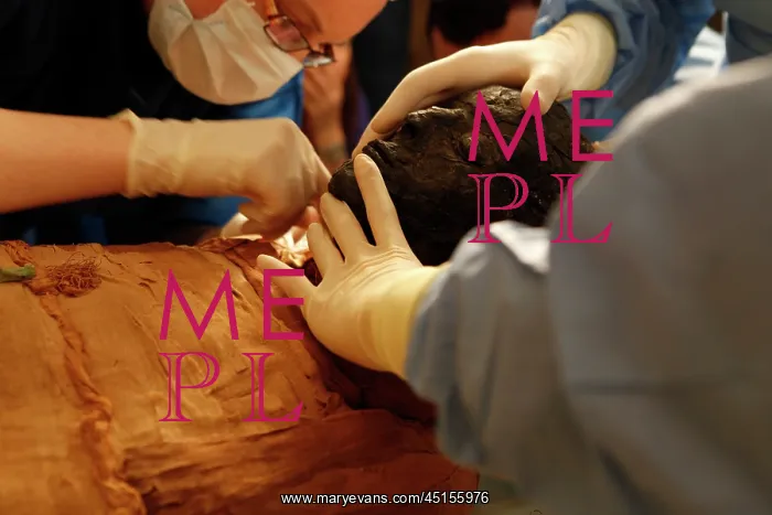 : Tissue sampling operation of an Egyptian mummy : Tissue sampling operation of an Egyptian mummy