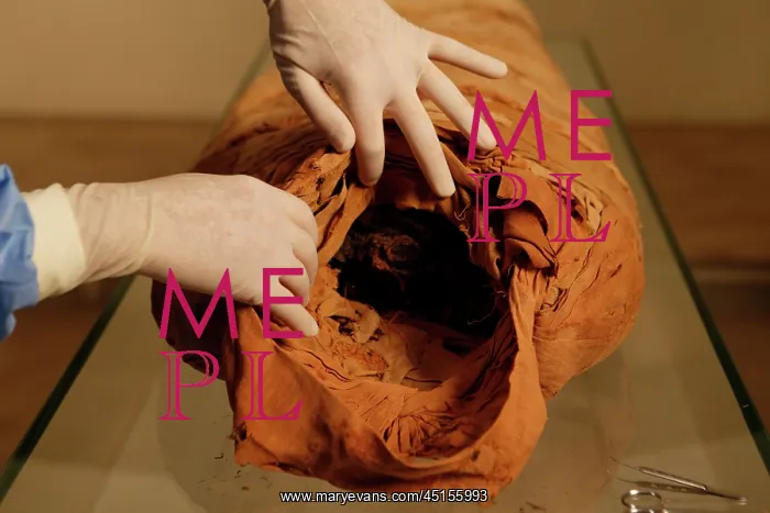 : Tissue sampling operation of an Egyptian mummy : Tissue sampling operation of an Egyptian mummy