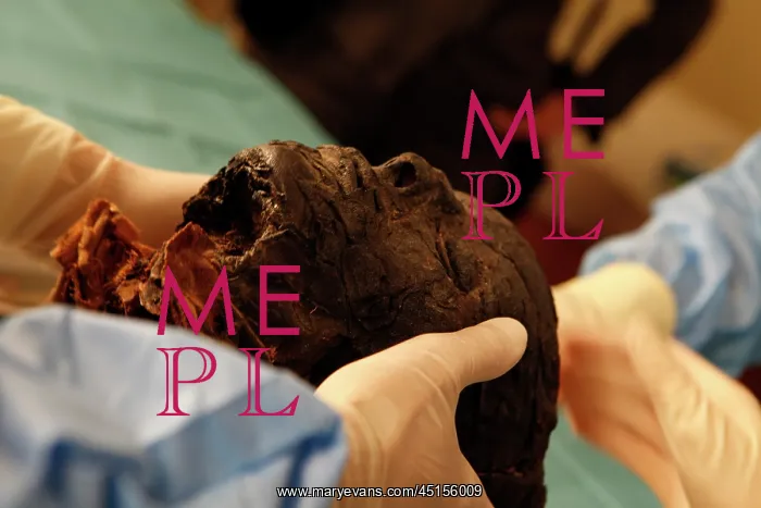 : Tissue sampling operation of an Egyptian mummy : Tissue sampling operation of an Egyptian mummy