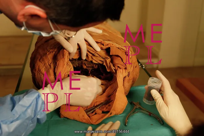 : Tissue sampling operation of an Egyptian mummy : Tissue sampling operation of an Egyptian mummy