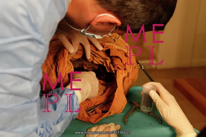 : Tissue sampling operation of an Egyptian mummy : Tissue sampling operation of an Egyptian mummy