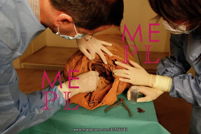 : Tissue sampling operation of an Egyptian mummy : Tissue sampling operation of an Egyptian mummy