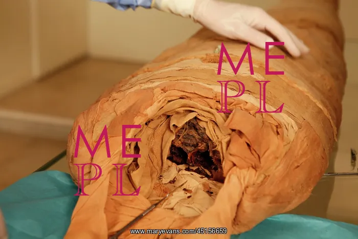  : Tissue sampling operation of an Egyptian mummy