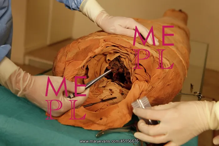: Tissue sampling operation of an Egyptian mummy : Tissue sampling operation of an Egyptian mummy