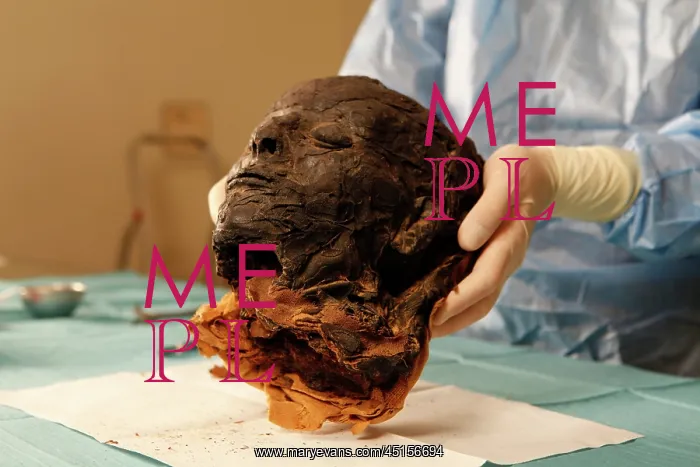: Tissue sampling operation of an Egyptian mummy : Tissue sampling operation of an Egyptian mummy