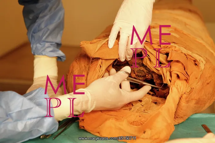: Tissue sampling operation of an Egyptian mummy : Tissue sampling operation of an Egyptian mummy