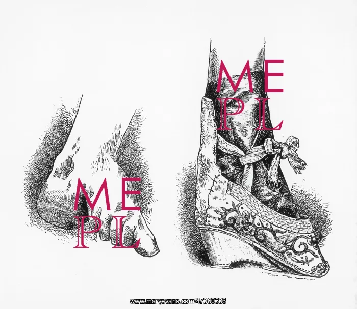 : Traditional Chinese Foot-Binding : Traditional Chinese Foot-Binding