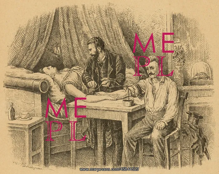: TRANSFUSING BLOOD, 1880 : TRANSFUSING BLOOD, 1880