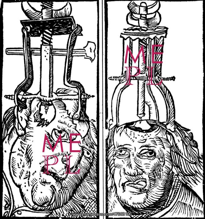 : Trepanning, 1525 : Trepanning, 1525