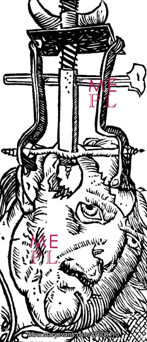 : Trepanning, 1525 : Trepanning, 1525