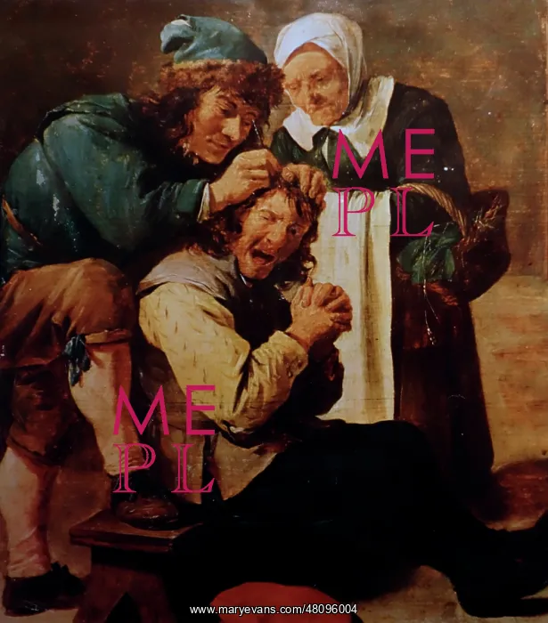 : Trepanning - hole drilled into human skull : Trepanning - hole drilled into human skull