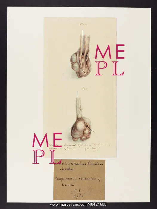 : Tubercles in a Monkey : Tubercles in a Monkey