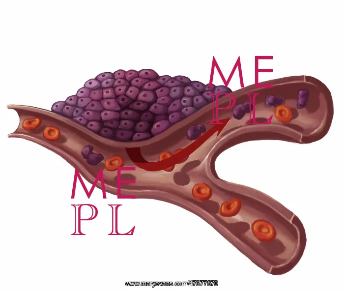 : Tumor Development, Illustration : Tumor Development, Illustration