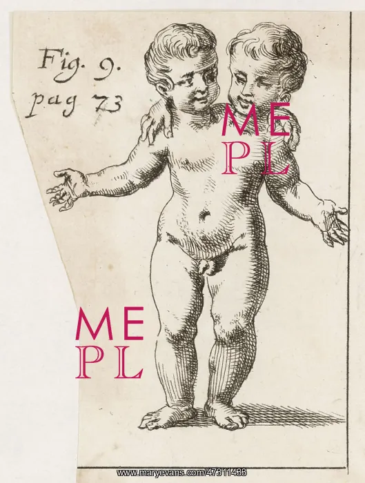 : TWO-HEADED CHILD / 1691 : TWO-HEADED CHILD / 1691