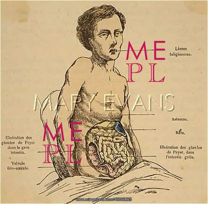  : TYPHOID / DIAGRAM