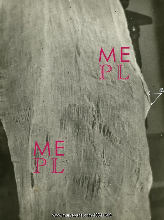 : Undated photograph of enlarged portion of ?ectoplasm? : Undated photograph of enlarged portion of ?ectoplasm?