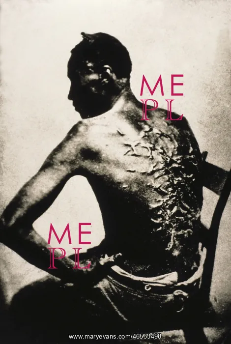 : United States (1863). Back of a black slave after : United States (1863). Back of a black slave after