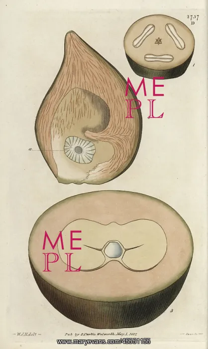 : Unripe fruit, sections of the double coconut : Unripe fruit, sections of the double coconut