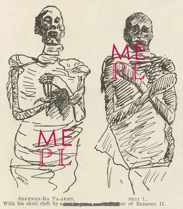 : Unrolling mummies at Cairo : Unrolling mummies at Cairo