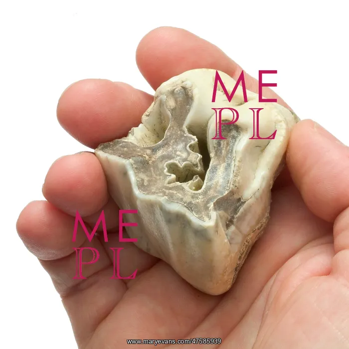 : Upper premolar of Stephanorhinus hundsheimensis : Upper premolar of Stephanorhinus hundsheimensis