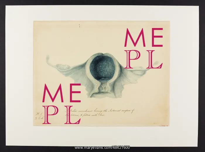 : Uterus: False Membrane Lining : Uterus: False Membrane Lining