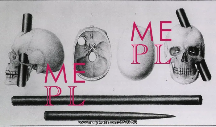 : Various views of the famous wound in the ? : Various views of the famous wound in the ?