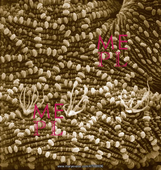 : Ventral surface of a mite from the prostigmatic species : Ventral surface of a mite from the prostigmatic species