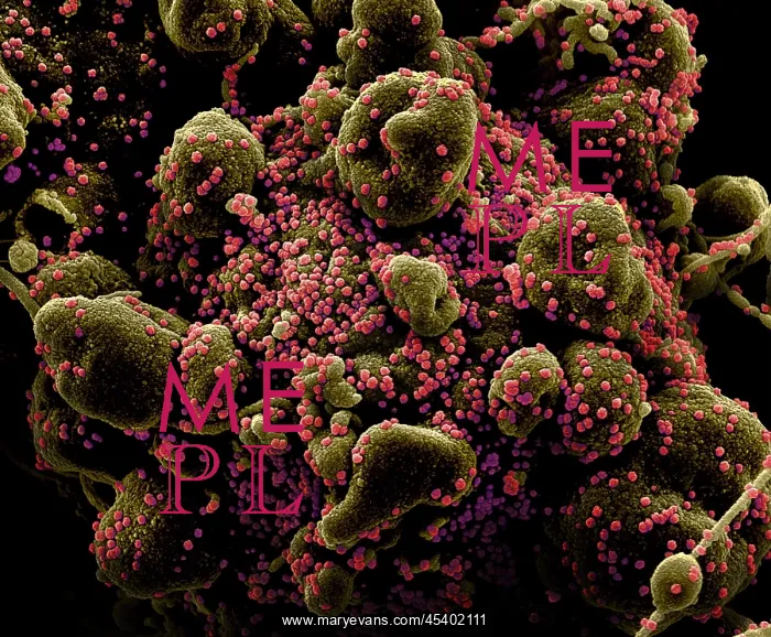  : VERO E6 cell (blue) heavily infected with SARS-COV-2