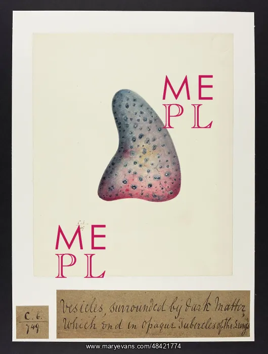 : Vesicles Surrounded by Dark Matter : Vesicles Surrounded by Dark Matter