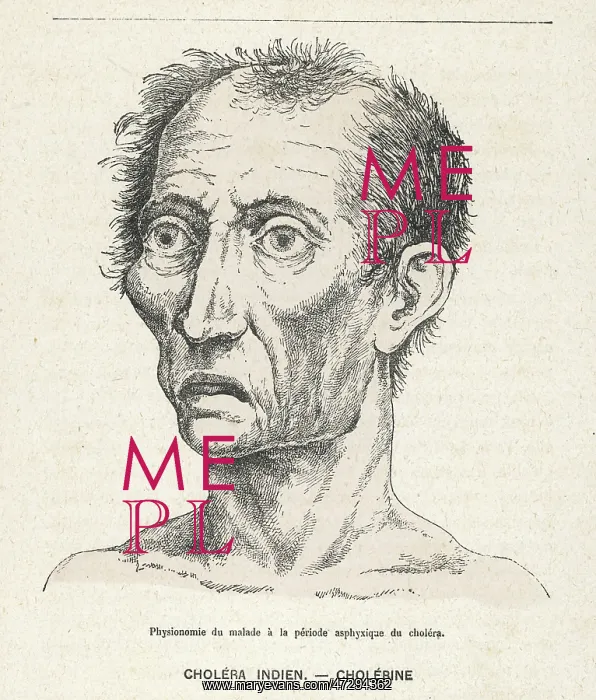 : VICTIM OF CHOLERA / 1883 : VICTIM OF CHOLERA / 1883