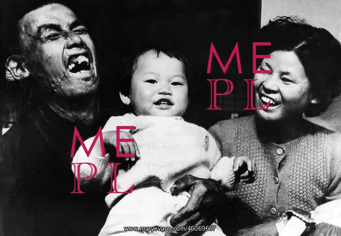  : Victims of Hiroshima