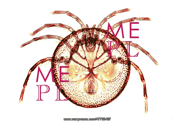 : Water Mite, M. Orbicularis, Early Photomicrograph : Water Mite, M. Orbicularis, Early Photomicrograph