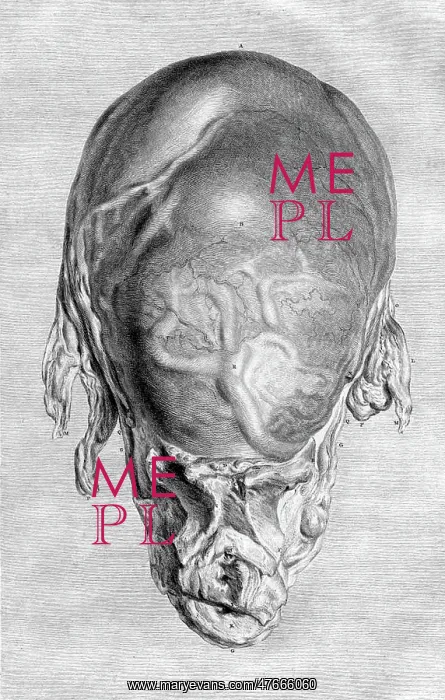 : William Hunter, Anatomia uteri humani gravidi, 1774 : William Hunter, Anatomia uteri humani gravidi, 1774