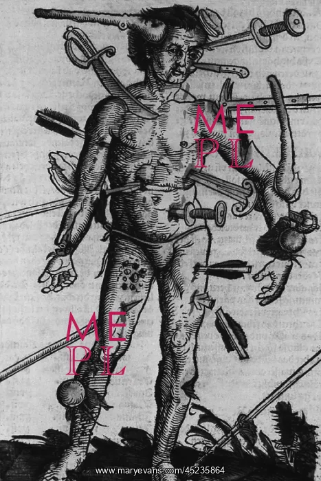 : WOUND MAN. A man with wounds from many different ? : WOUND MAN. A man with wounds from many different ?