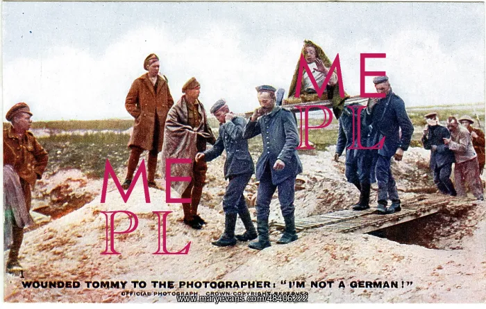 : Wounded British soldier, WW1 : Wounded British soldier, WW1