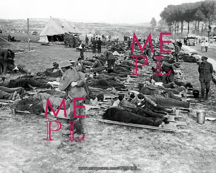 : Wounded British soldiers, Western Front, WW1 : Wounded British soldiers, Western Front, WW1