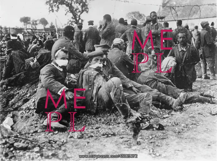 : Wounded German prisoners of war, WW1 : Wounded German prisoners of war, WW1
