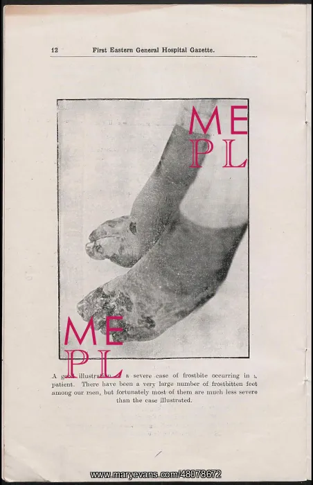 : WW1 - First Eastern General Hospital Gazette : WW1 - First Eastern General Hospital Gazette