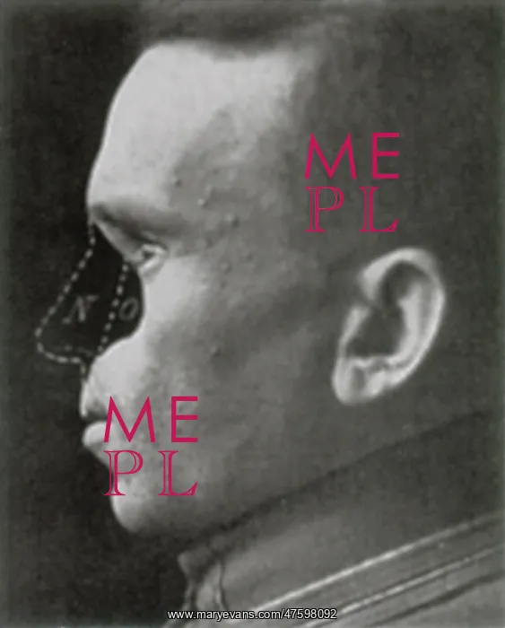 : WWI Veteran Needing Reconstructive Surgery : WWI Veteran Needing Reconstructive Surgery
