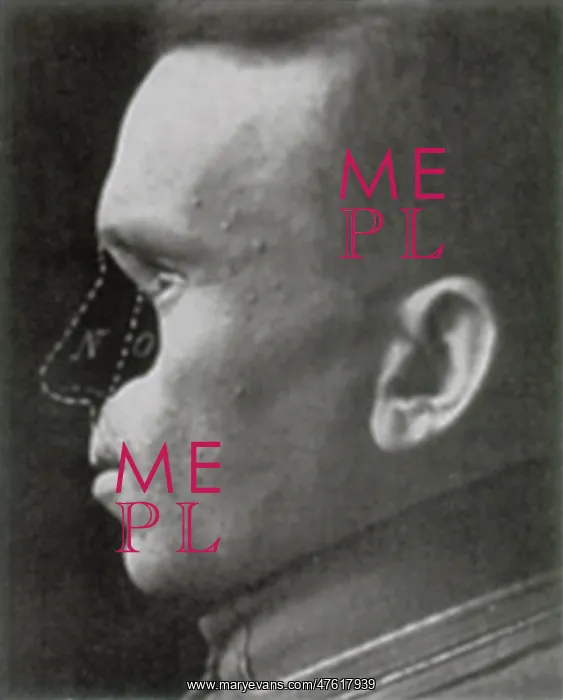 : WWI Veteran Needing Reconstructive Surgery : WWI Veteran Needing Reconstructive Surgery