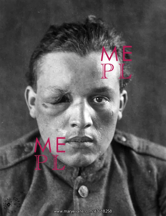 : WWI, Wounded Soldier : WWI, Wounded Soldier