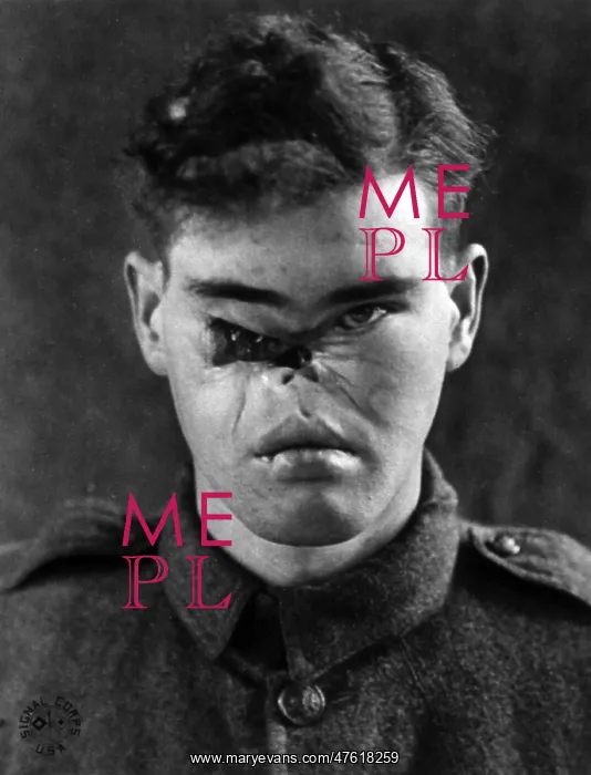 : WWI, Wounded Soldier : WWI, Wounded Soldier