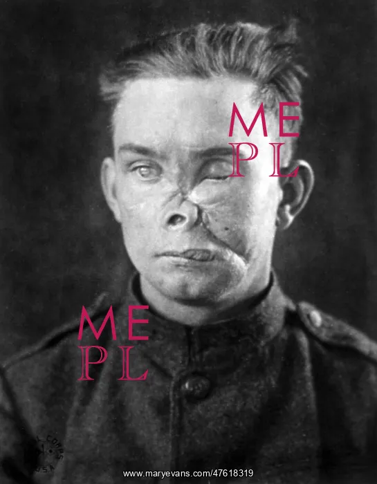 : WWI, Wounded Soldier : WWI, Wounded Soldier