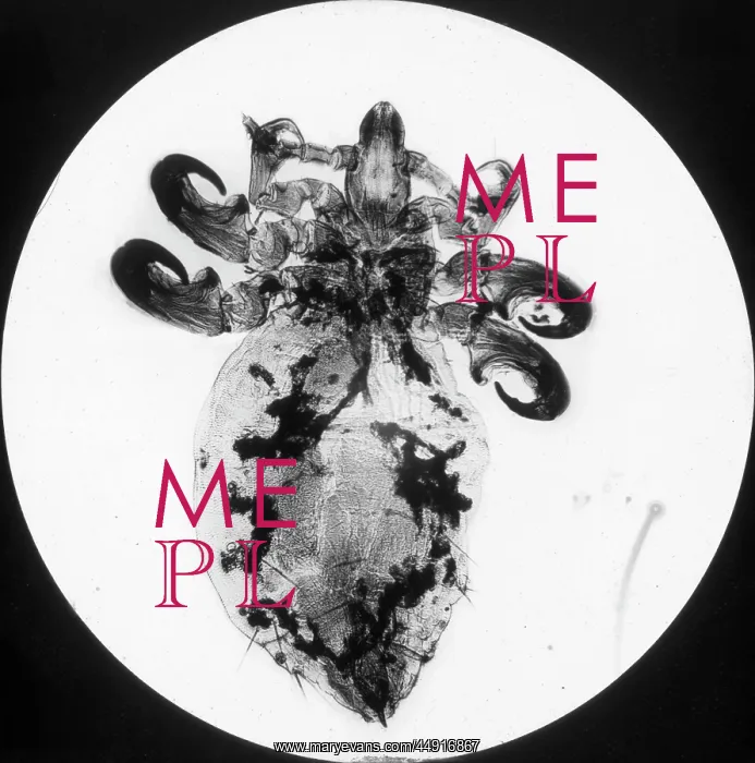: X-Ray - Antelope Parasite : X-Ray - Antelope Parasite