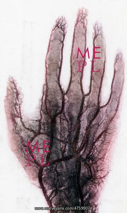 : X-ray of Blood Vessels : X-ray of Blood Vessels