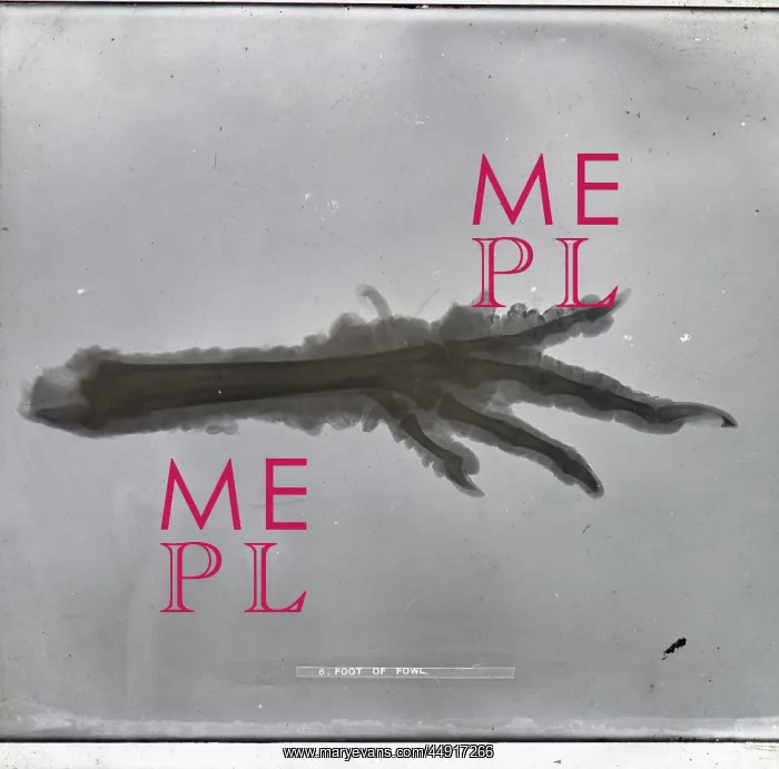 : X-Ray - Claw Foot : X-Ray - Claw Foot