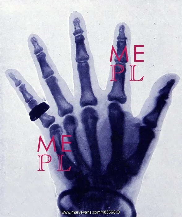 : X-Ray halftone presentation of a full hand with : X-Ray halftone presentation of a full hand with