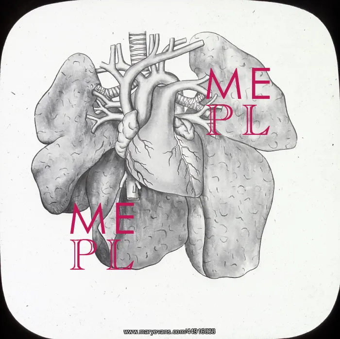 : X-Ray - Heart and Lungs : X-Ray - Heart and Lungs